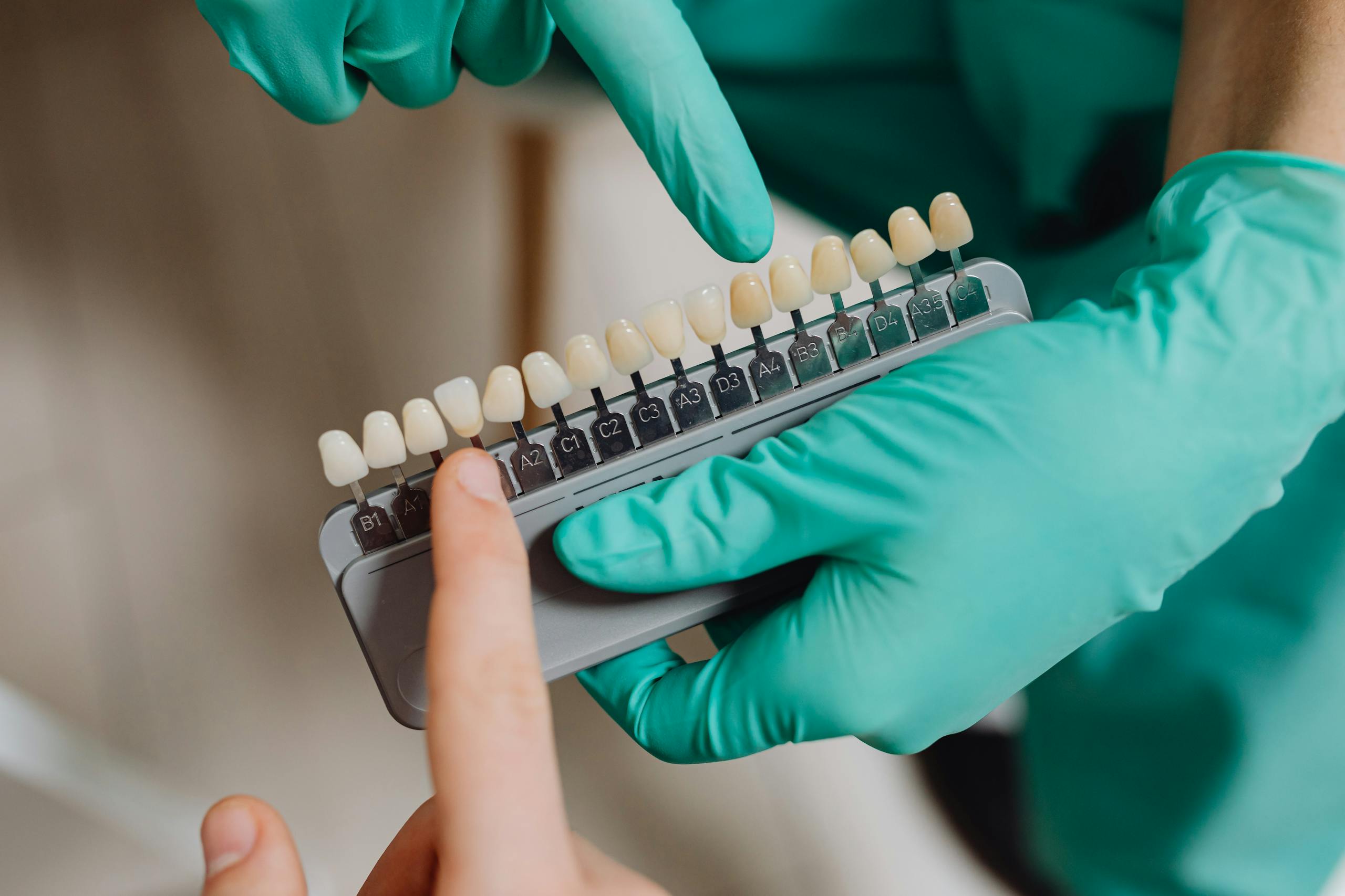 Dental professional with gloves pointing to a dental shade guide in a clinic.